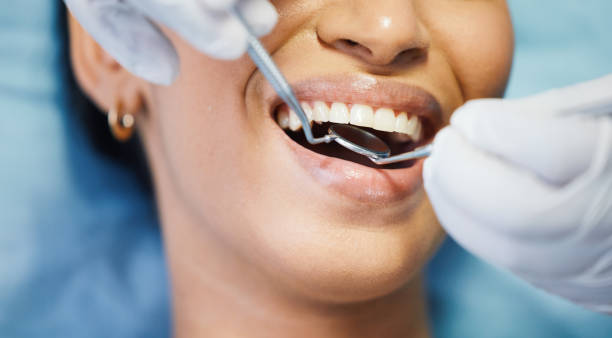Best Dental Abscess Treatment in Ione, CA