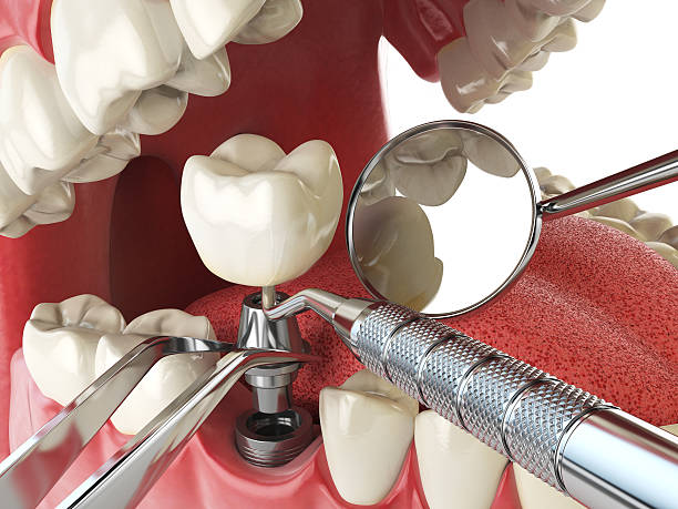 Best Walk-In Emergency Dental Services in Ione, CA